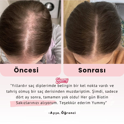 Yummy® Günlük Biotin Kavanozu